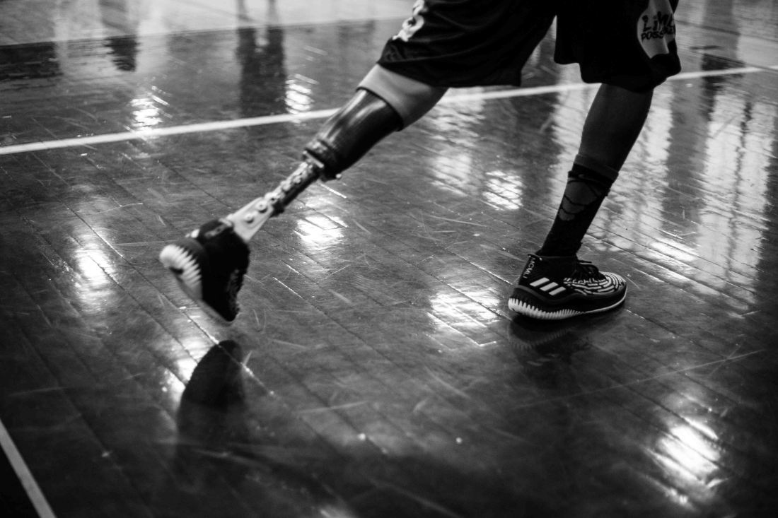 A shot of a prosthetic leg on a member of the Limb Possible team, who is about to break into a run. The only shot of the team that shows a prosthesis.
